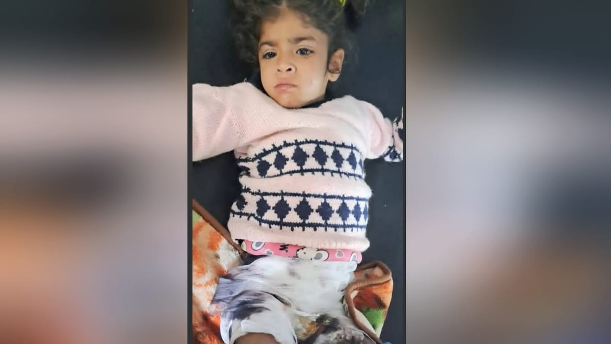 Himachal Kangra News: Stepmother pours boiling water on five year old girl in nurpur kangra