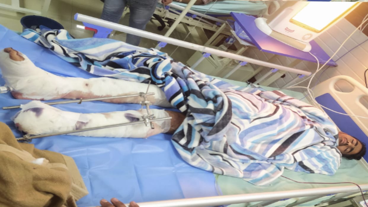 Fathers sad story only son also got his leg amputated, helplesss to get his treatment