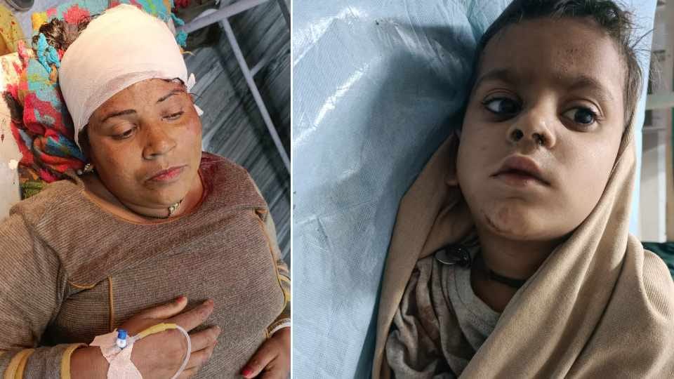 Mother and son injured due to roof collapse in Abohar