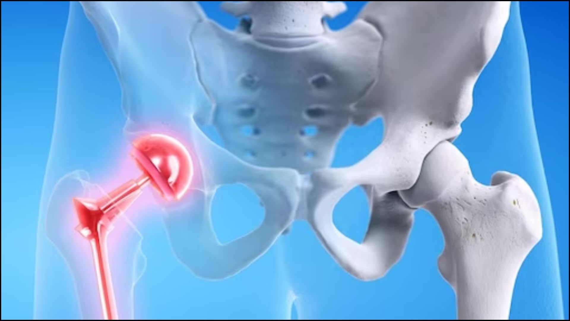 Author Taslima Nasreen Shares Pain On Delhi Private Hospital Forced Her