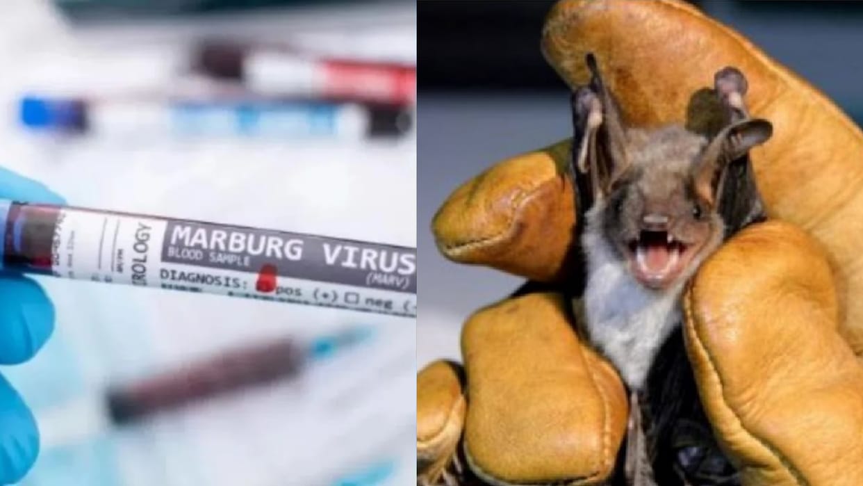 Marburg Virus increased the concern of the world including India, if you see these symptoms, be alert
