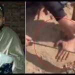 हरदीप उर्फ राजू अपनी कटी अंगुलियां दिखाते हुए।