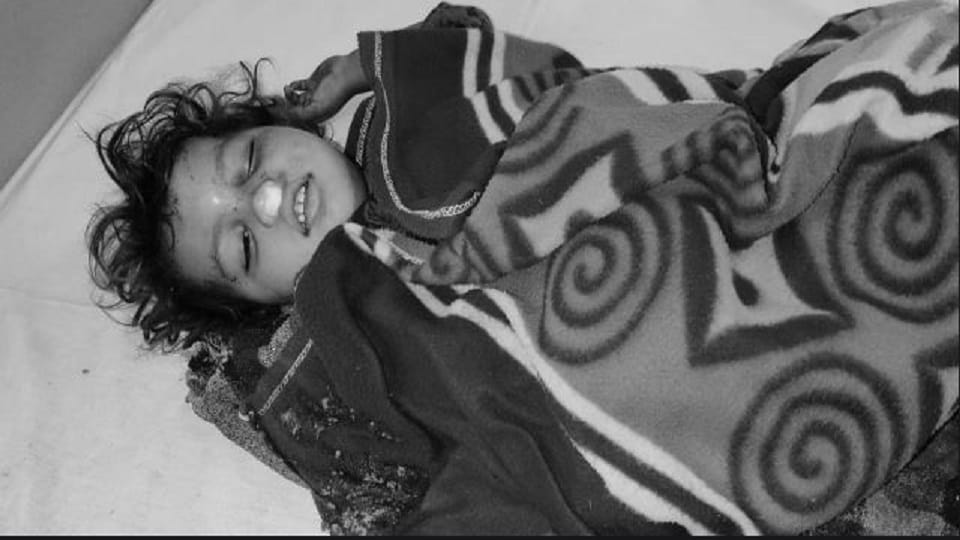 Four year old girl fell down from second floor due to monkey attack in Bareilly