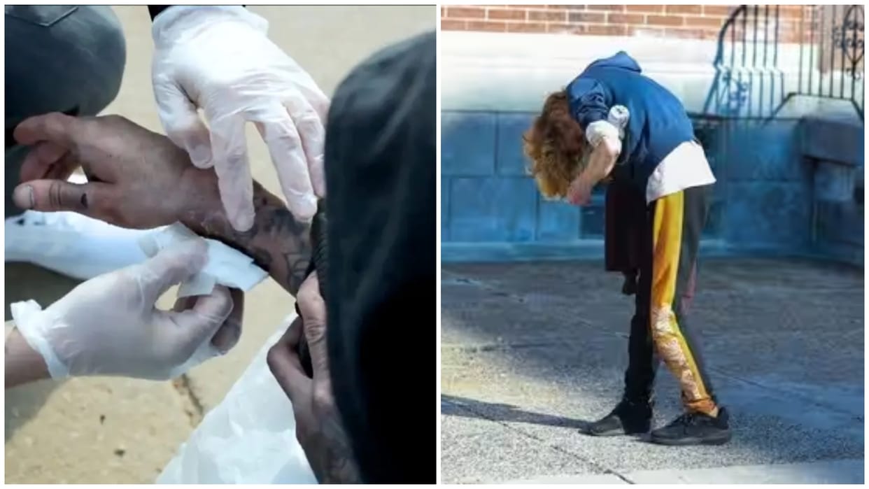 zombie drug xylazine rotten skin symptoms tranq dope american cities alert