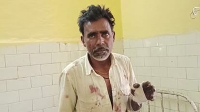 दमोह में तेंदुए के हमले में घायल संतु बंसल।