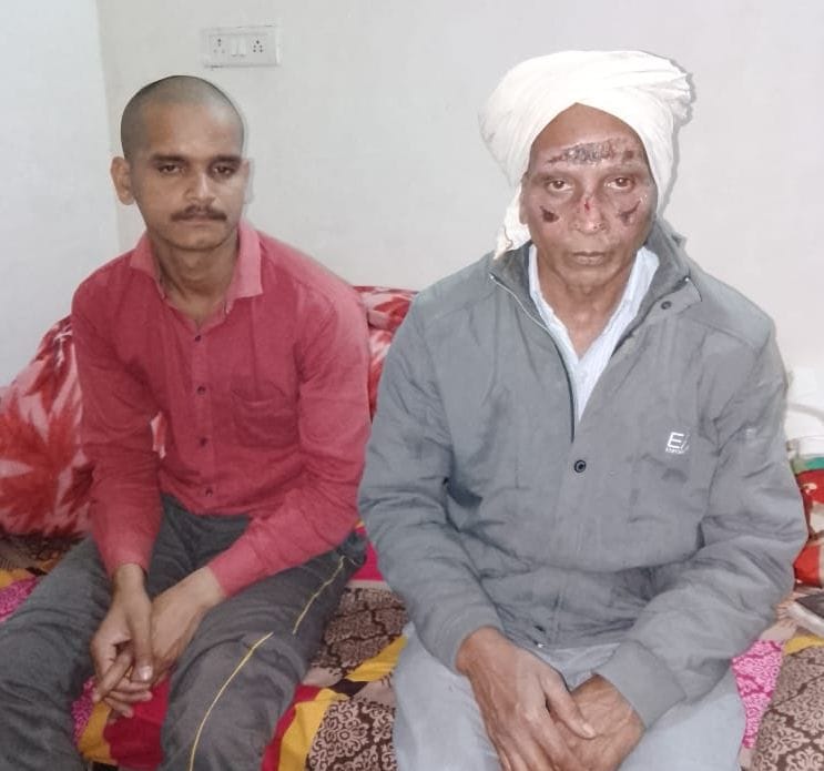 Kanpur Dehat: DNA test will be done to identify the dead bodies of mother-daughter burnt in Madauli village, samples of father-son will be taken