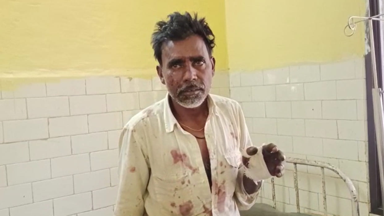 MP News: Father fought with leopard to save his daughter in Damoh, kept fighting till the animal was chased aw