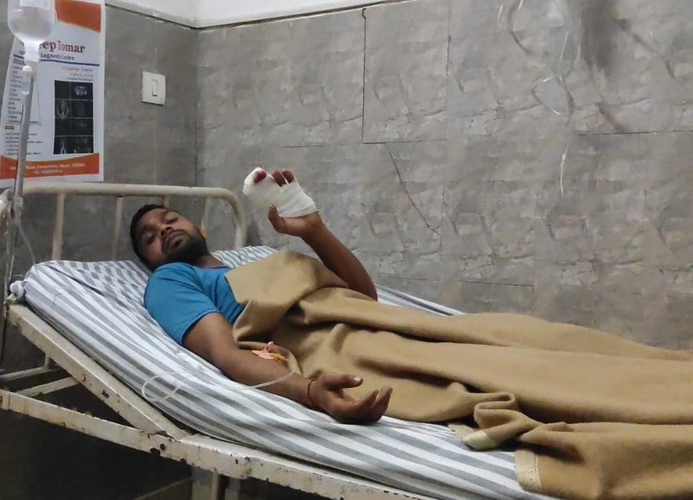 youth injured due to fireworks in a wedding in Sardhana Meeerut