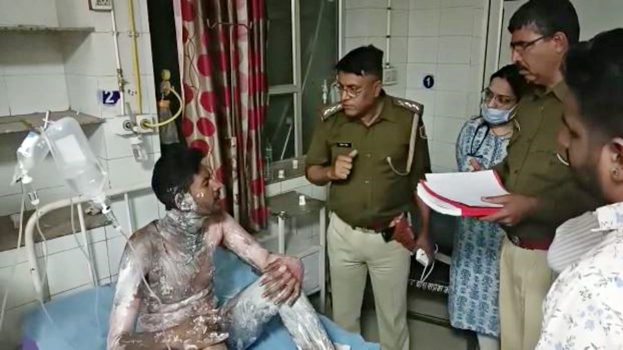 Youth sets himself on fire by sprinkling petrol outside bus stand