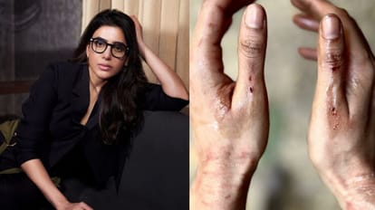 Samantha Prabhu: नैनीताल में शूटिंग के दौरान घायल हुई ऊ अंटावा गर्ल, अपने सोशल मीडिया अकाउंट पर बयां किया दर्द शूटिंग के दौरान घायल हुई सामंथा रुथ प्रभु