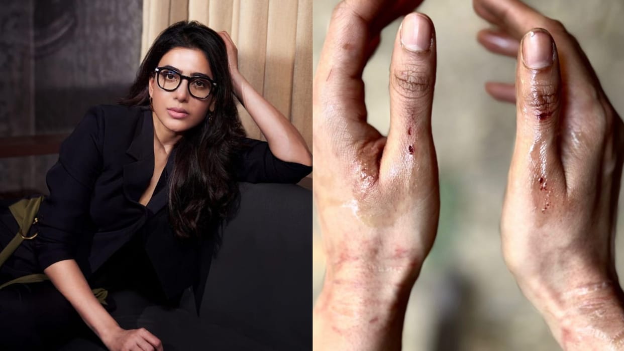 Actress Samantha Ruth Prabhu injured during shooting in Nainital Shares Pic Of Bruised Hands Uttarakhand