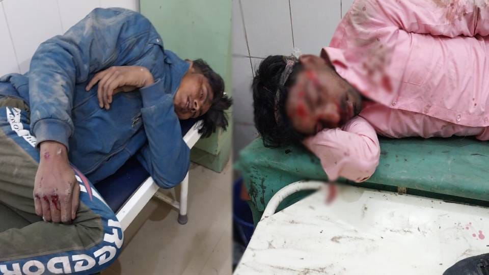 One laborer died and three are in critical condition due to speeding truck collision in Kasganj