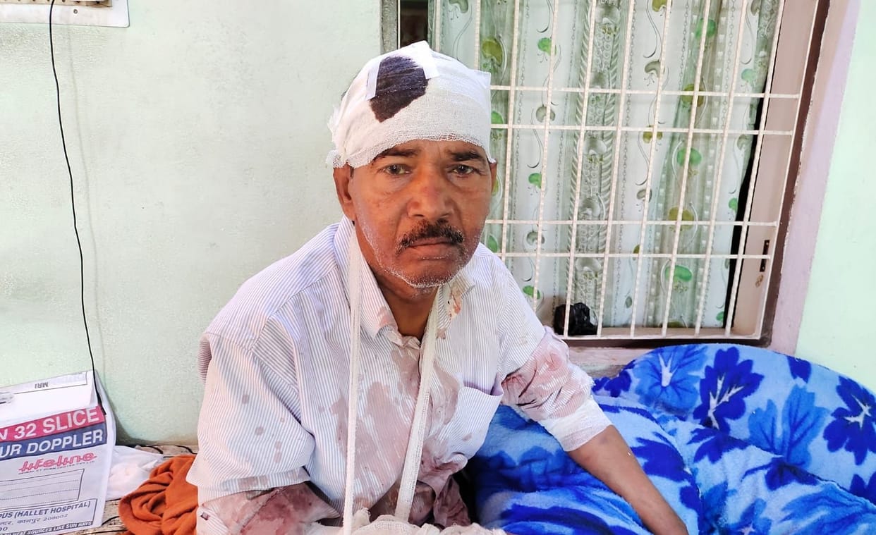 the goons beat up the retired ADO and his wife for not paying for liquor in Auraiya
