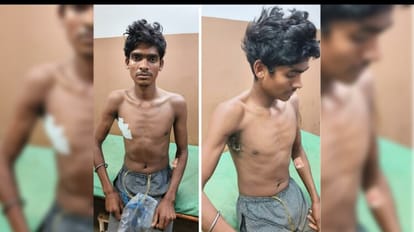 सुअर का शिकार करने में युवक को लगी गोली, घायल हालत में अस्पाताल में भर्ती।