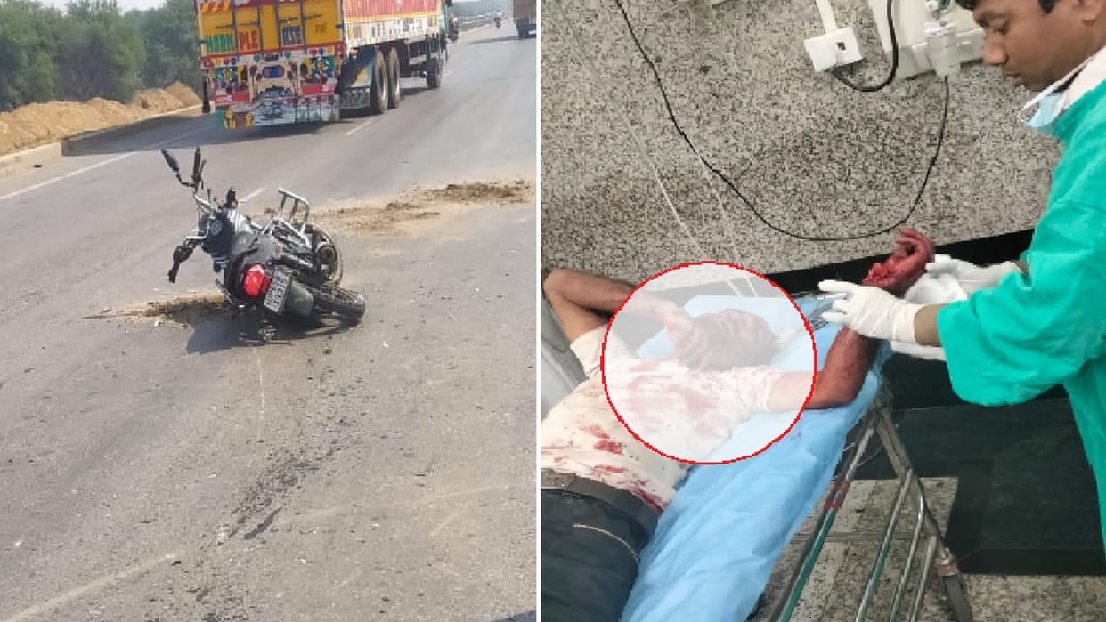 Heavy collision between truck and bike, bike rider fell on the road, condition critical