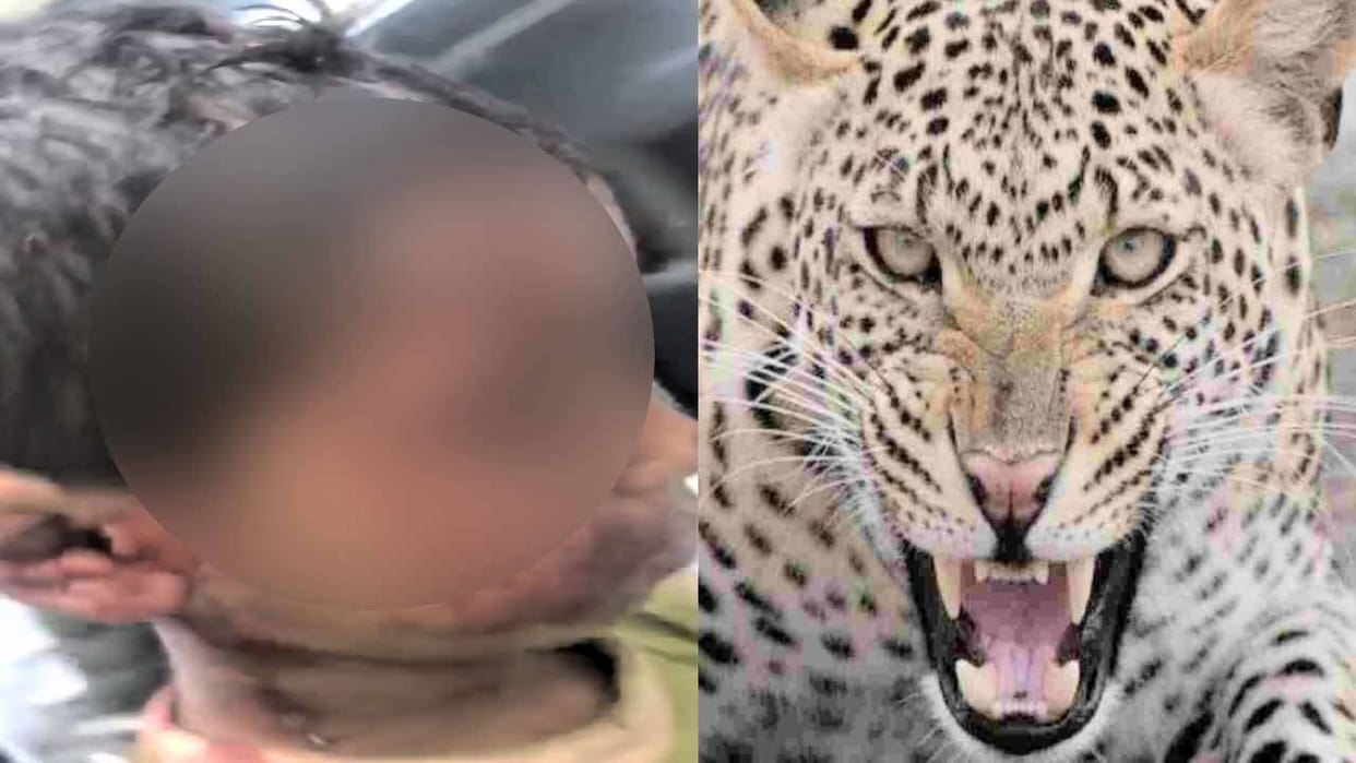 Leopard attacked the child going with the mother in nerwa shimla