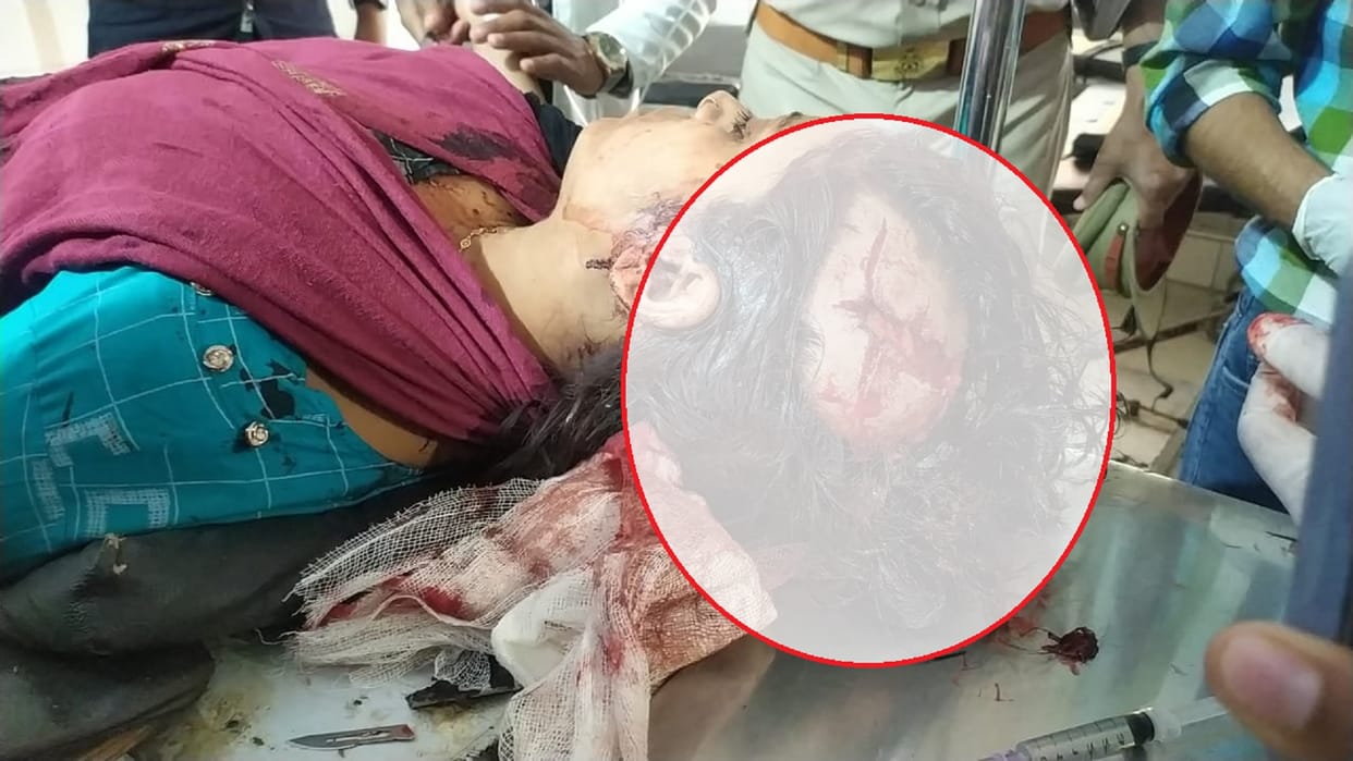 Azamgarh crime Lover shot girlfriend on the head at Dhaba, then opened fire on himself, youth died, created r