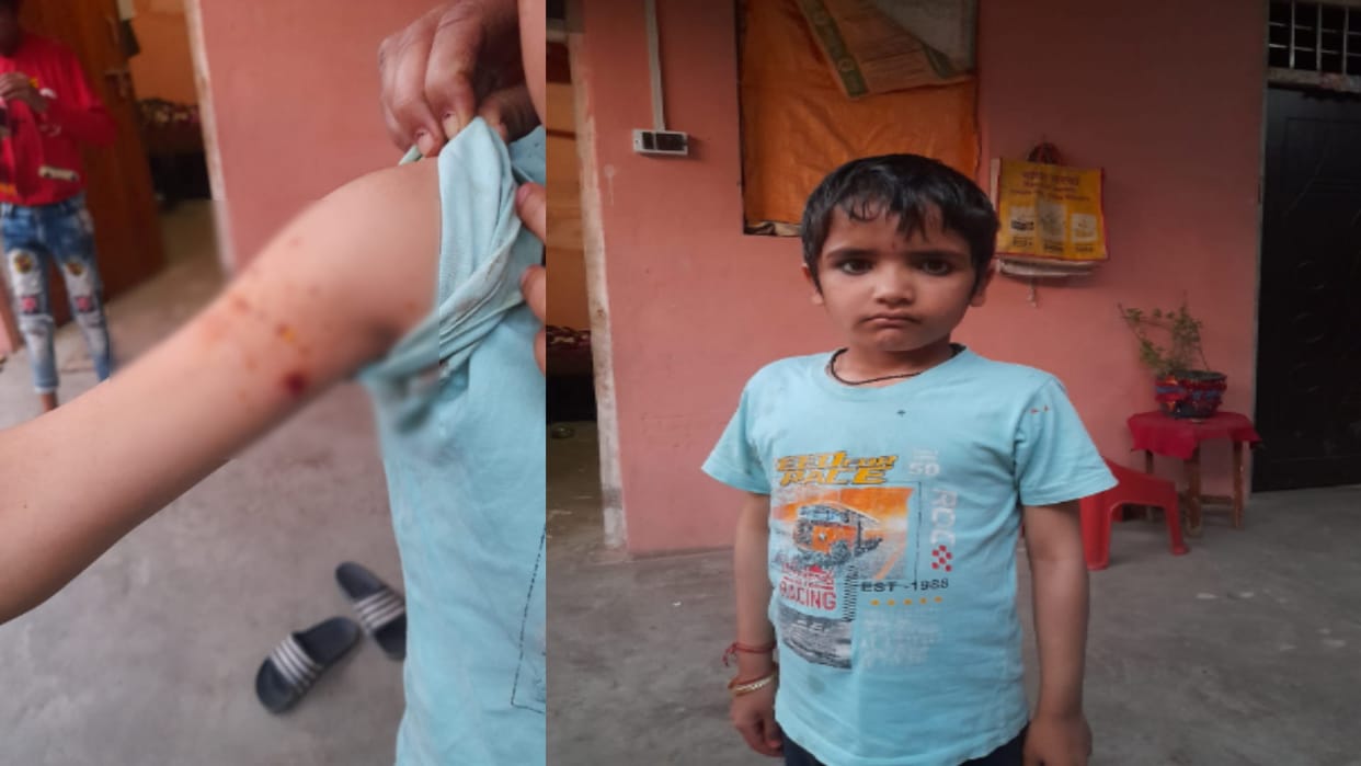 Saharanpur: Dogs attacked two children in Gangoh and the condition is critical of a child