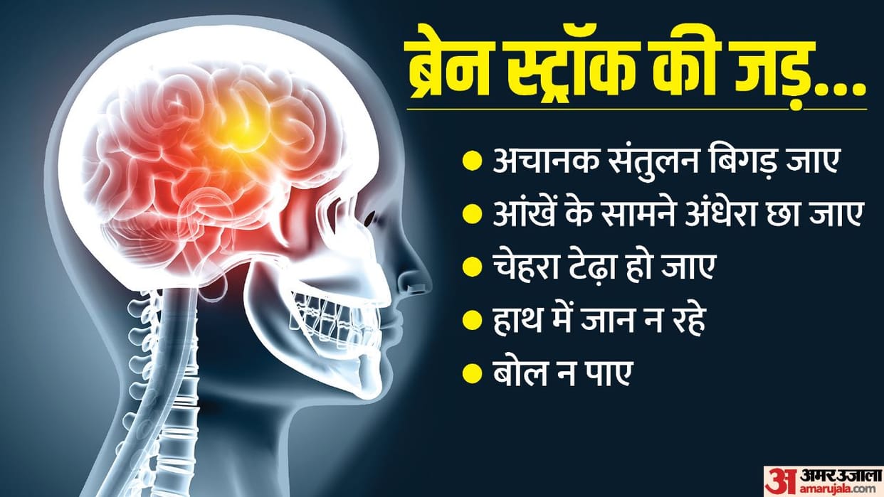 youth of the country increasingly becoming victims of brain stroke know its prevention and identification