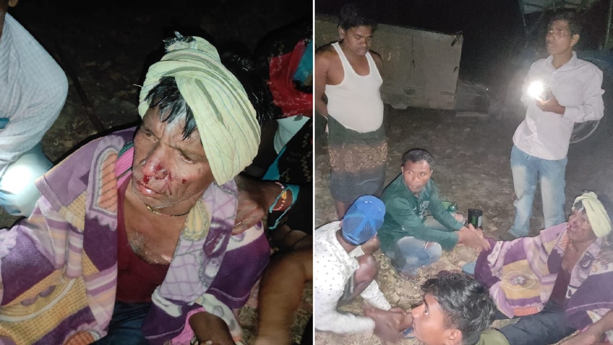 Villager injured due to electrocution laid for hunting wild boar