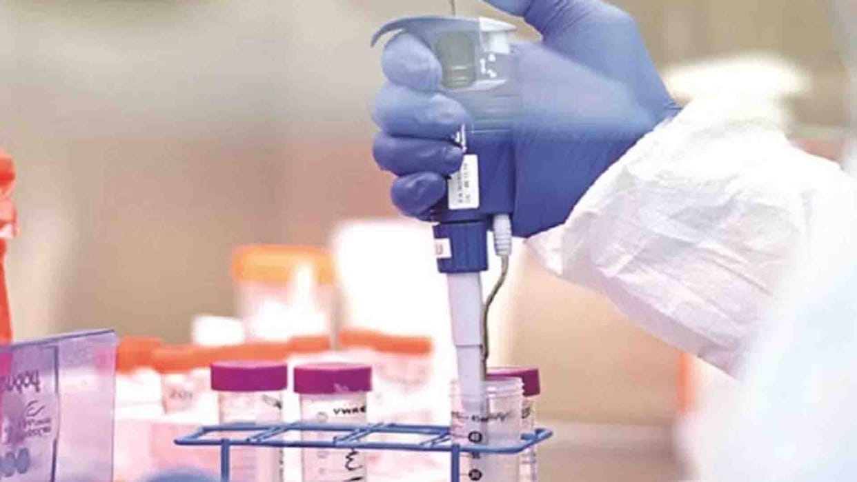 Kanpur: RT PCR test of H3N2 will also be done along with Covid