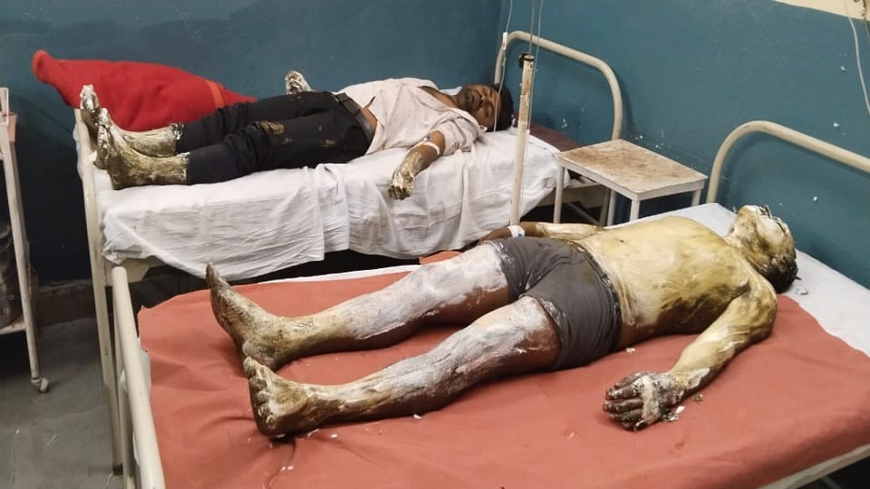 Cylinder caught fire while cooking three brothers burnt condition of two critical in Bulandshahr