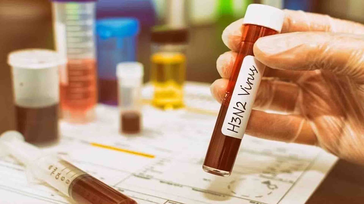 Kanpur: H3N2 guideline sent to health centers, nursing homes
