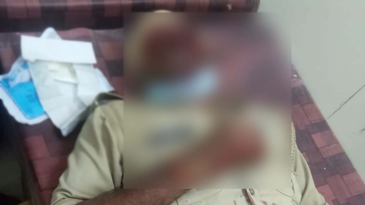 Meerut News: A constable has died due to treatment in a hospital after eating poison