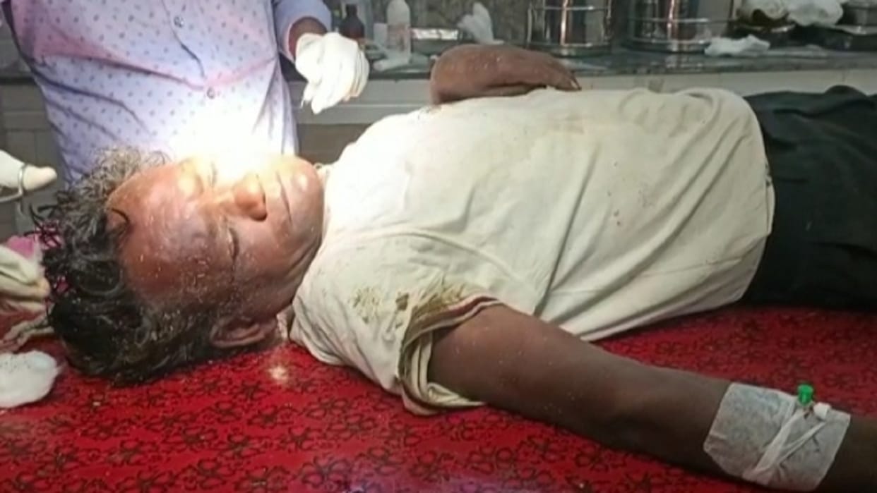 Many people were injured in the attack of bees in Balkonagar of Korba