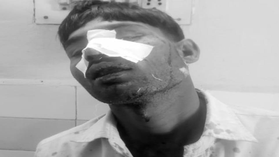 young man fought and saved his life in leopard attacked in lakhimpur kheri