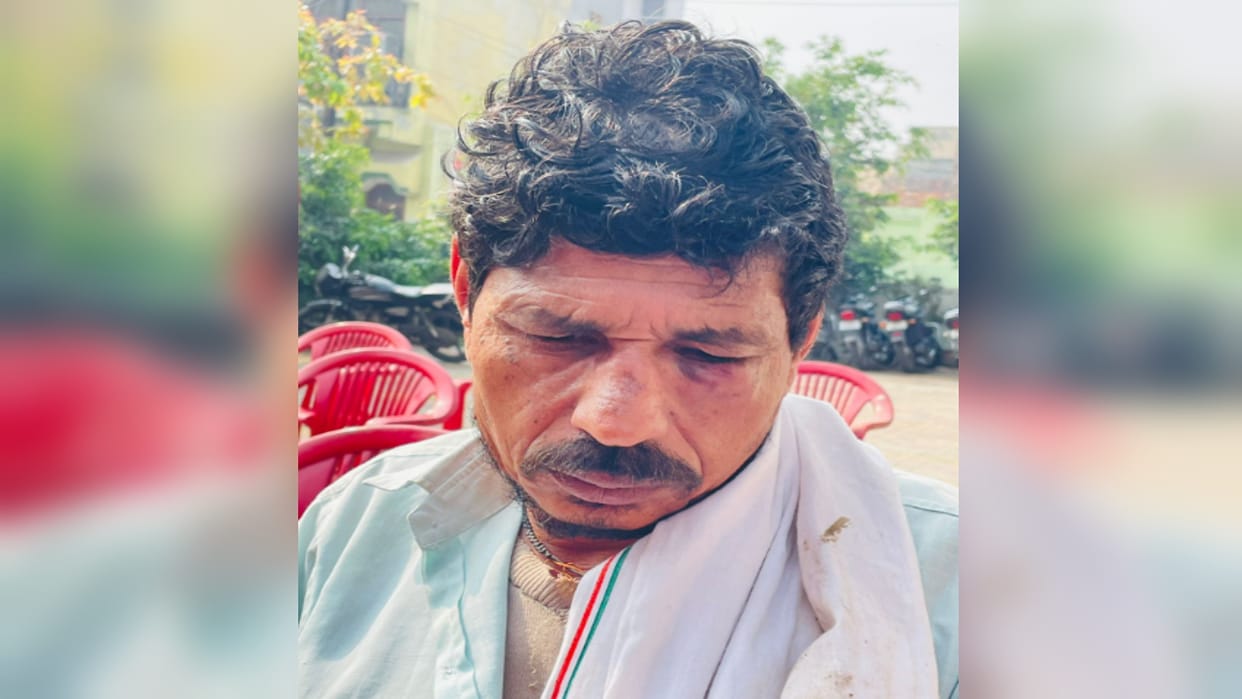 Baghpat: man beaten by community special for not giving grocery items for borrow ,two injured