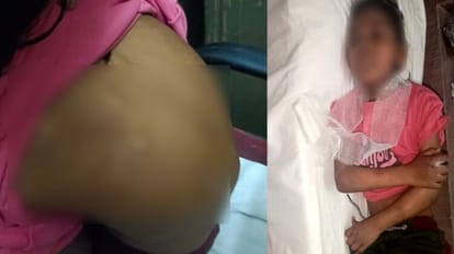 बच्ची से बर्बरता की हदें पार: पिता ने किया था बच्ची का सौदा, आरोपी दंपती ने उठने-बैठने लायक तक नहीं छोड़ा बच्ची से बर्बरता