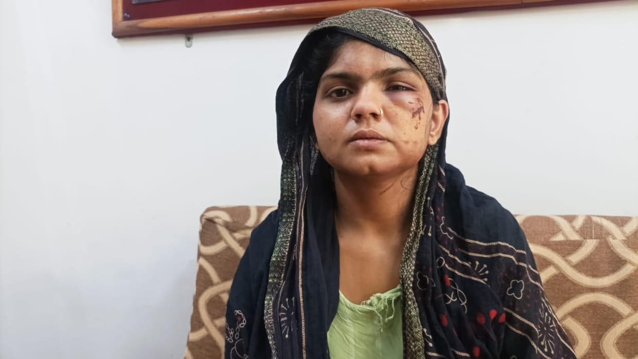 Woman councilor Sapna Malviya was beaten up by husband, case filed against in-laws, husband arrested