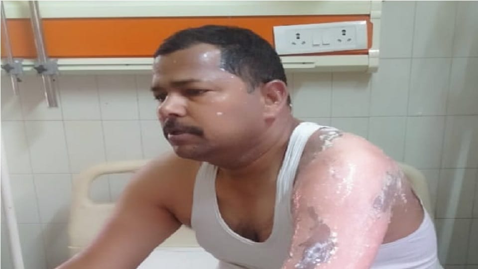 Two policemen got scorched due to blast in body spray while burning garbage in Dubaulia police station of Bast