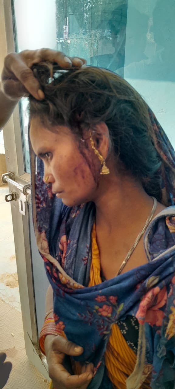 Umaria News: Tiger attacked in Bandhavgarh Tiger Reserve, attacked a woman who went to pick Mahua