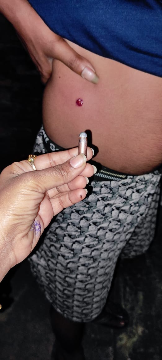 Chandauli: Thieves ran away after failing to steal, a bullet hit a villager in the stomach