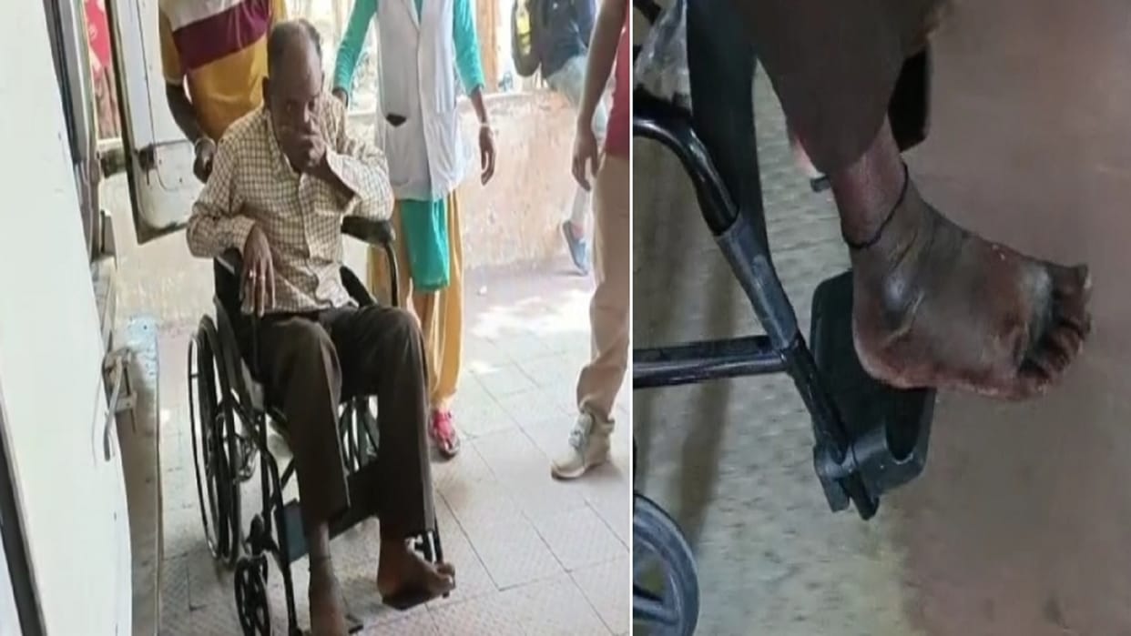 Swelling of leg increased due to exorcism doctor said leg will have to be amputated