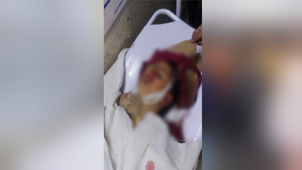 The children were going to buy chocolates, during a child died after being buried under the debris
