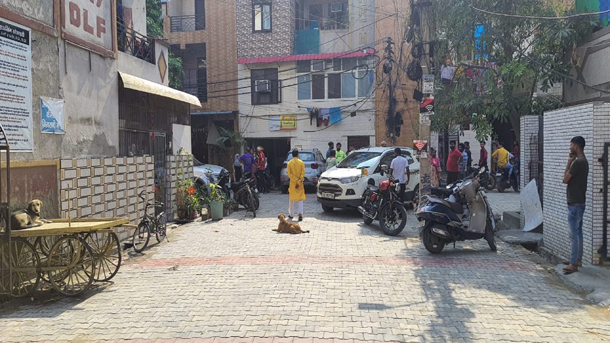 Ghaziabad Pitbull Attack Dog Attack Child Injured Playing Outside House In Ghaziabad UP News in Hindi
