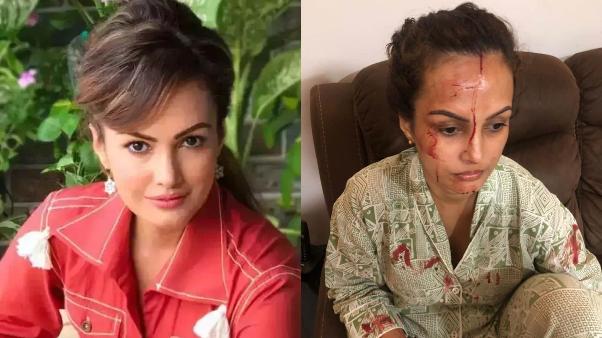 Television Famous Actress Who Faced Domestic Violence Shweta Tiwari Dalljeet Kaur Rashmi Desai Nisha Rawal