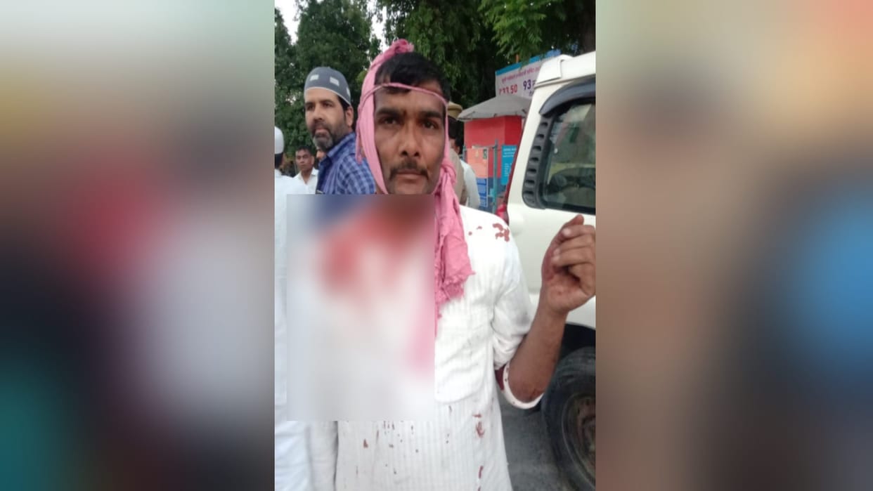 Fight between two parties in Saharanpur and eight people including female village head were injured