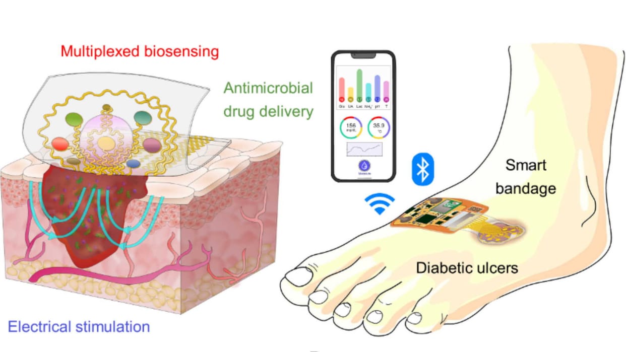 Smart Bandages Can Treat Diabetic Ulcer Wound,Know Full Details in Hindi