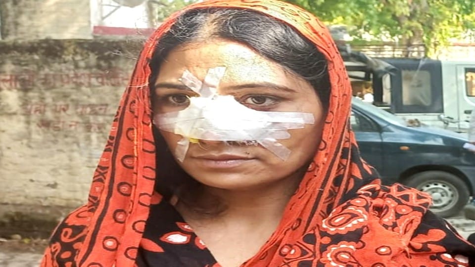 Husband brutally beat wife and cut off her nose in Bareilly