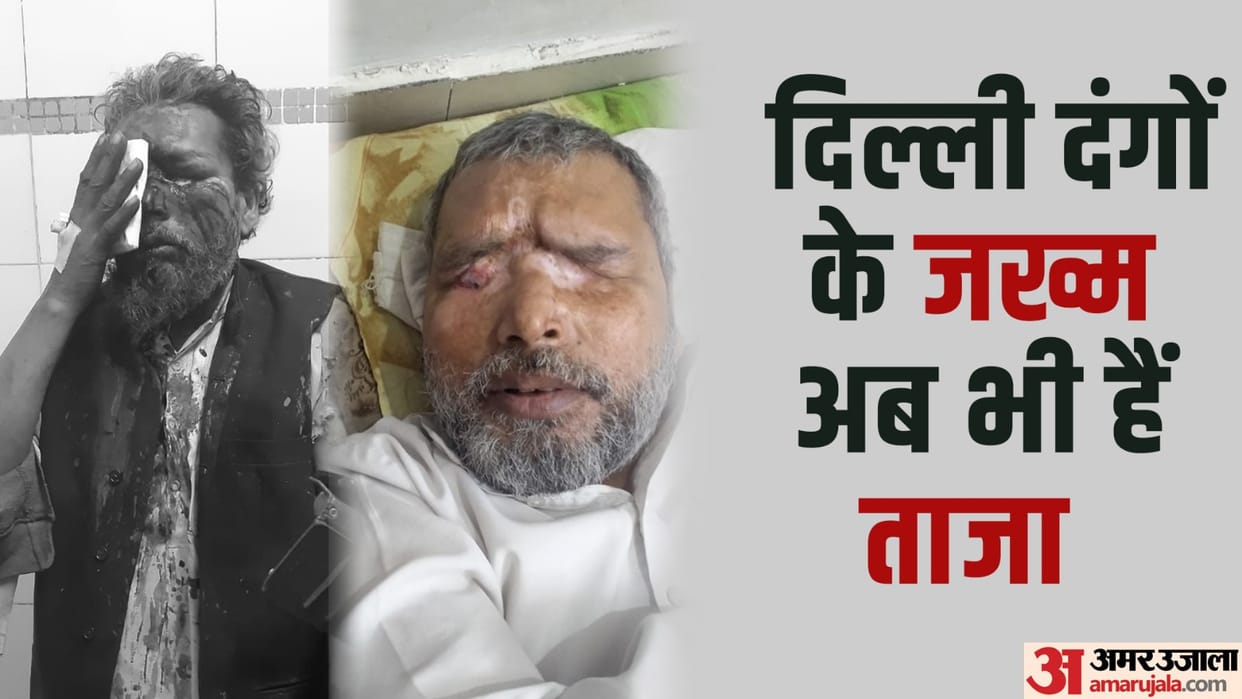 delhi riots rioters poured acid on both the eyes of Mohammad Vakil on 25 February 2020