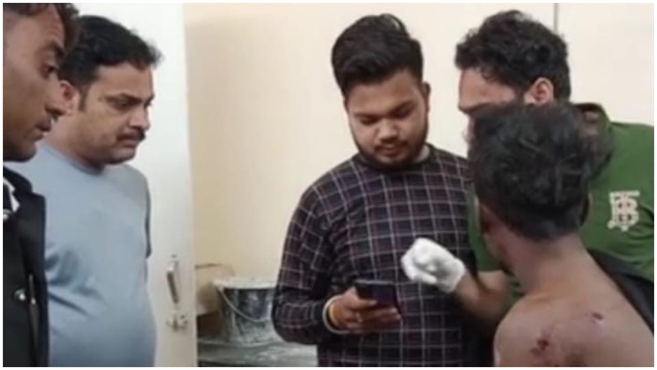 Camel attacked youth in Churu bitten on chest and back Rajasthan news