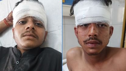 Accident on Purvanchal Expressway Ambulance going to Bihar overturned four seriously injured