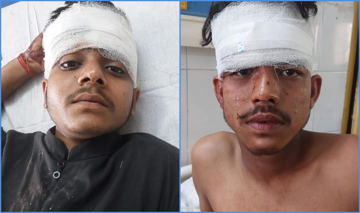Accident on Purvanchal Expressway Ambulance going to Bihar overturned four seriously injured