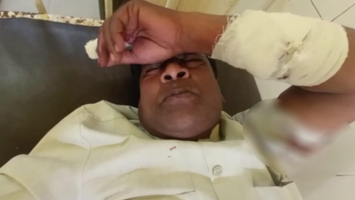 Morena News Former MLA Satyaprakash Sakhwar injured in dog attack