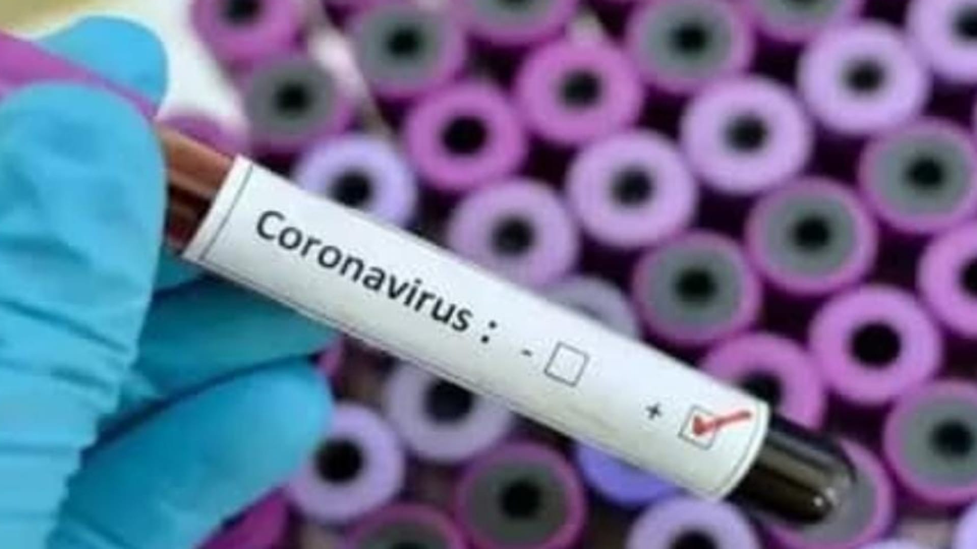 80 per cent increase in worldwide covid cases, New Covid variant ERIS risk factors and complications