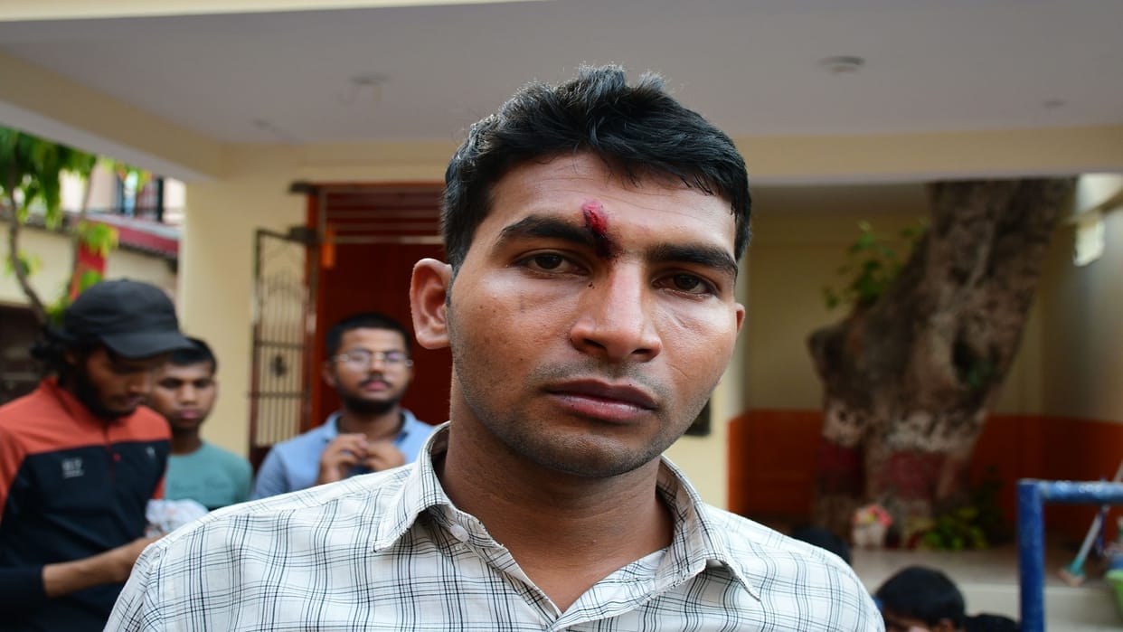 Allahabad University: Students of two hostels clashed, four injured in stone pelting, people from both sides s